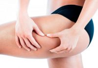 Celulitis